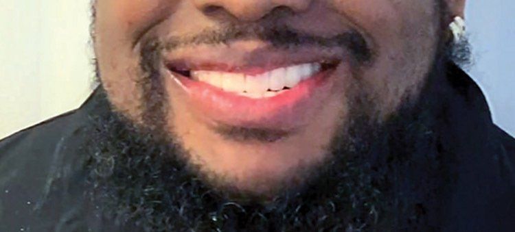 Patient after completed full-mouth restoration