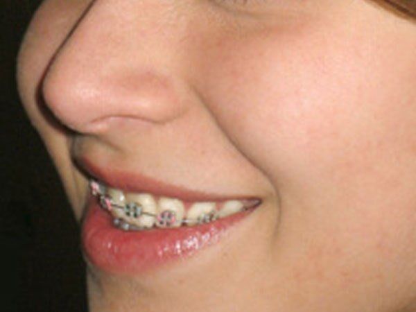 SONRISANAR - Ortodoncia