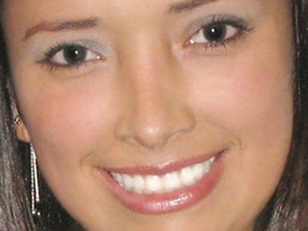 SONRISANAR - Diseño de Sonrisa