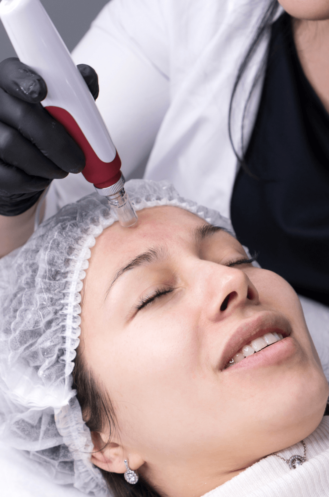 A woman getting mesotherapy near her browline