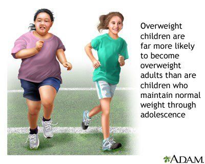 Childhood obesity problem