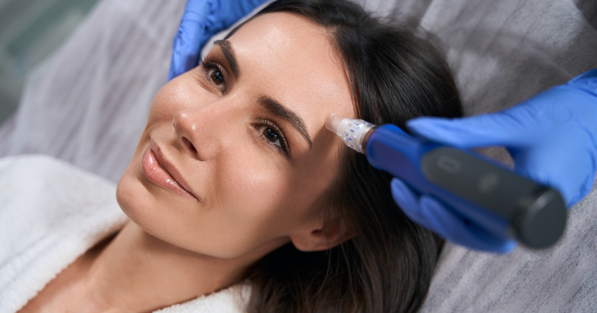 The Long-Term Benefits of Regular Microneedling Treatments