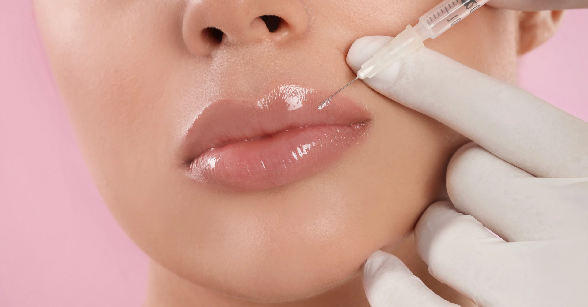 Is It Safe to Combine Lip Injections with Botox® or Other Treatments?