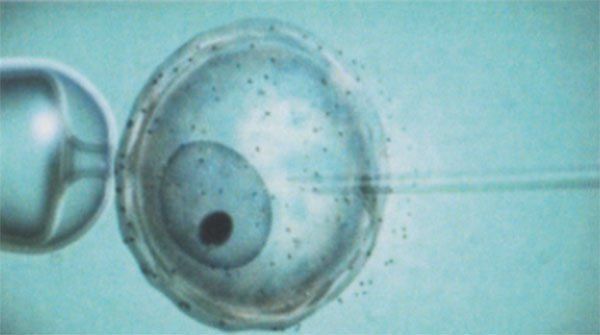 Fecondazione assistita