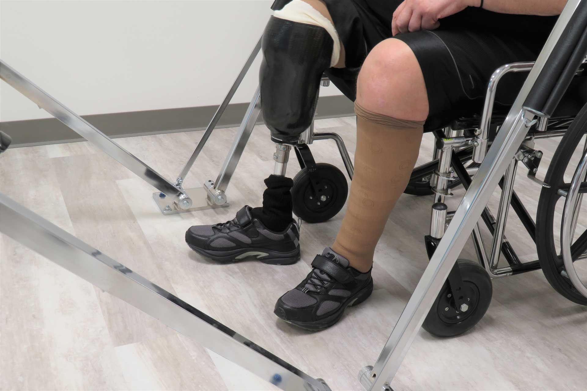 A man with a prosthetic leg is sitting in a wheelchair.