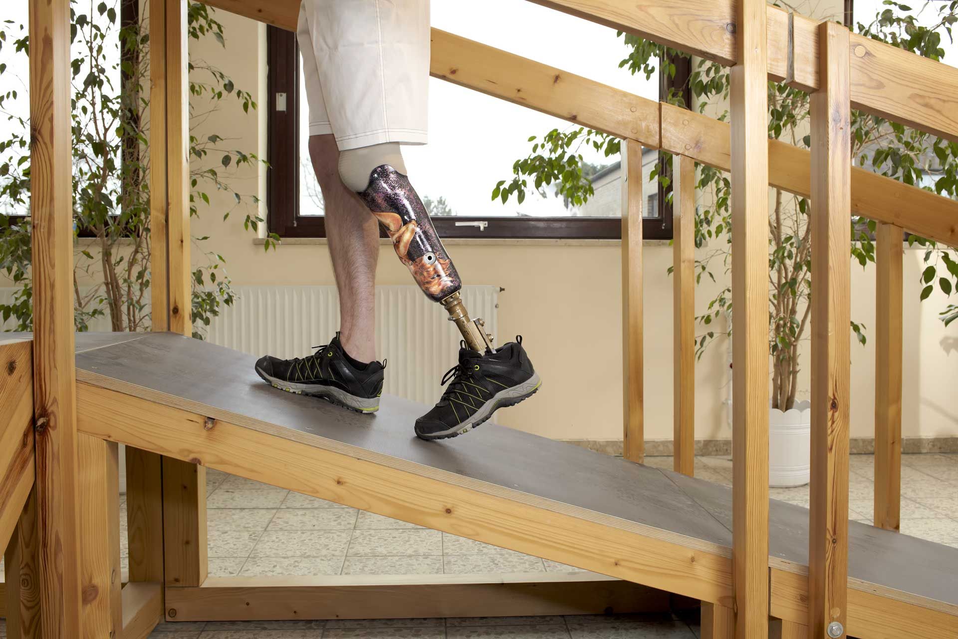 A man with a prosthetic leg is walking down a wooden ramp