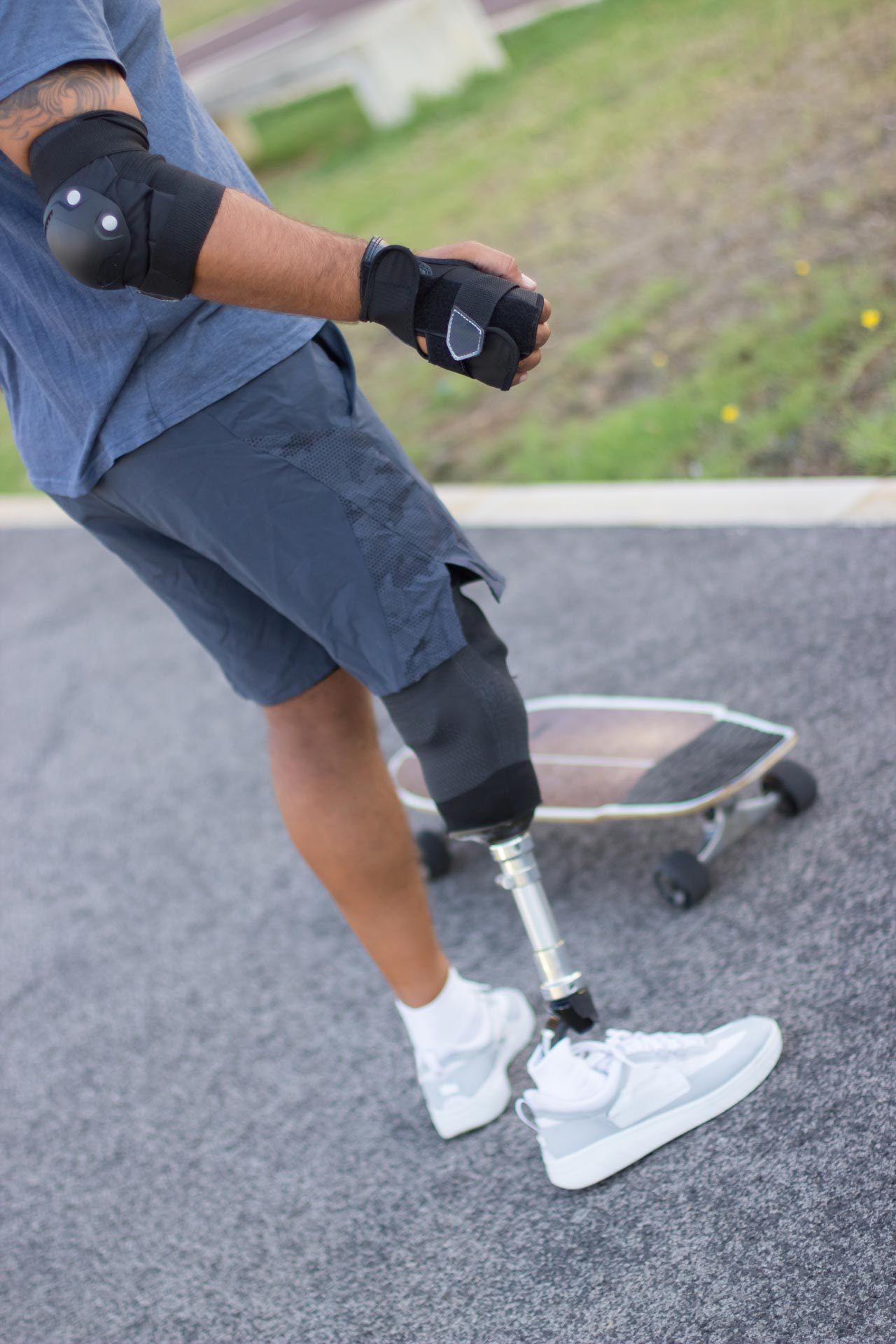 A man with a prosthetic leg is riding a skateboard.