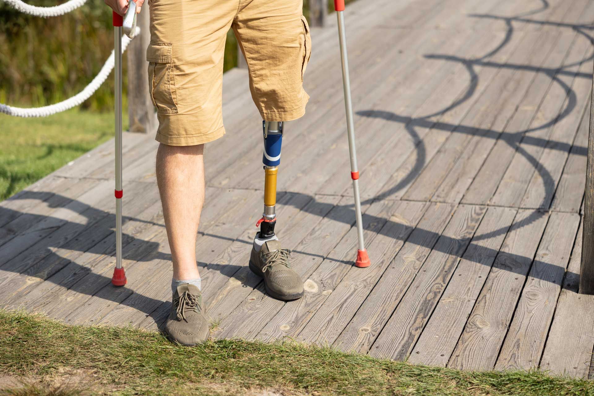 A man with a prosthetic leg is walking on crutches.
