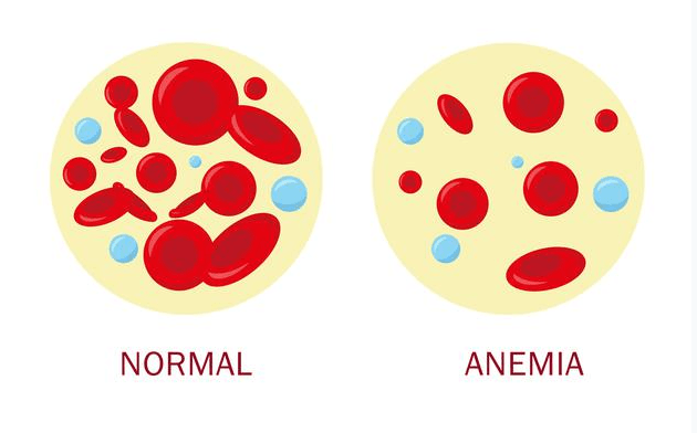 Comparação entre o sangue normal e com anemia