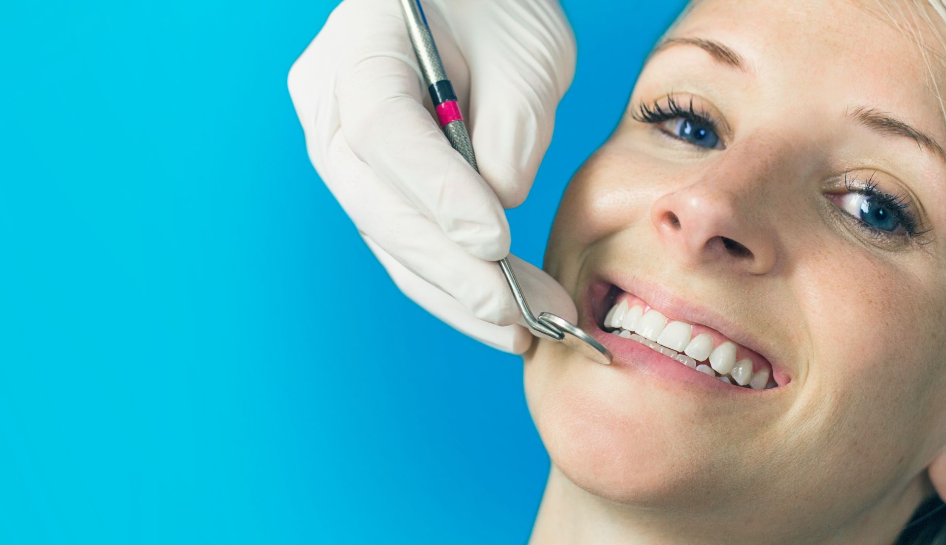 Sorriso sbiancato
