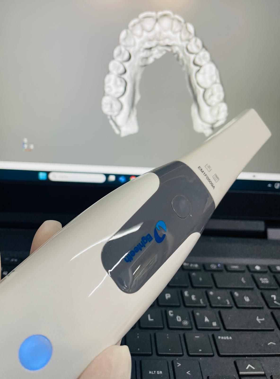 Mano che tiene uno scanner intraorale con un modello dentale digitale 3D visualizzato su un monitor.