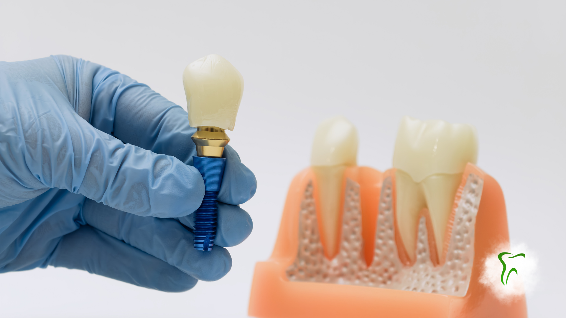 Gloved hand holding a dental implant beside a model of gums and teeth