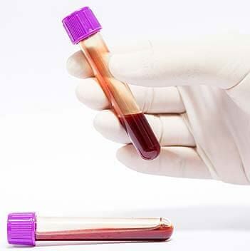 Laboratorio de análisis clínicos