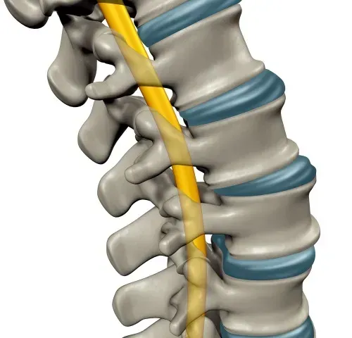 A Spine With a Yellow Nerve   — Mark O'Brien Chiropractic in West End, QLD
