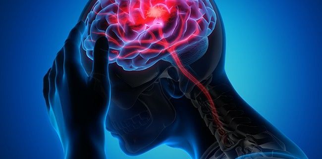 A Woman is Holding Her Head Because of a Headache — Mark O'Brien Chiropractic in West End, QLD