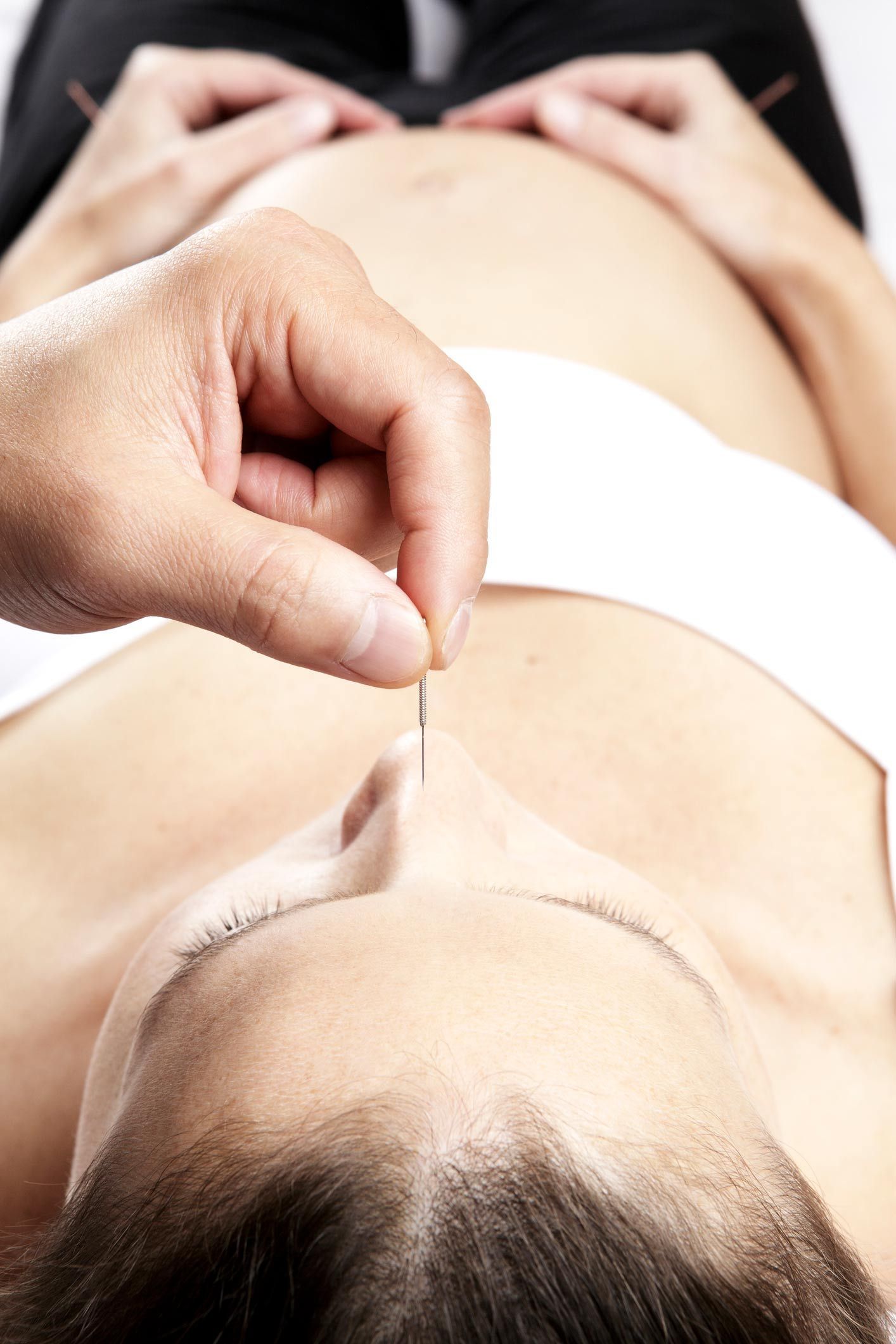 Pregnant undergoing acupuncture | Kiralee, QLD | Master Therapies