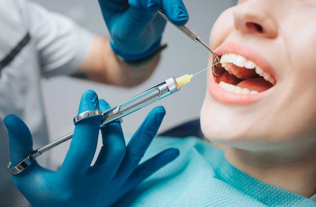 How Long Does Dental Numbness Last After Local Anesthesia?