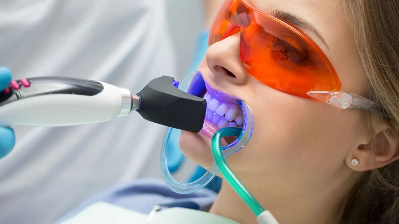 Affordable Teeth Whitening Near Me Affordable Teeth Whitening Near Me