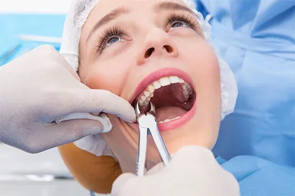 Tooth Extractions Near Me