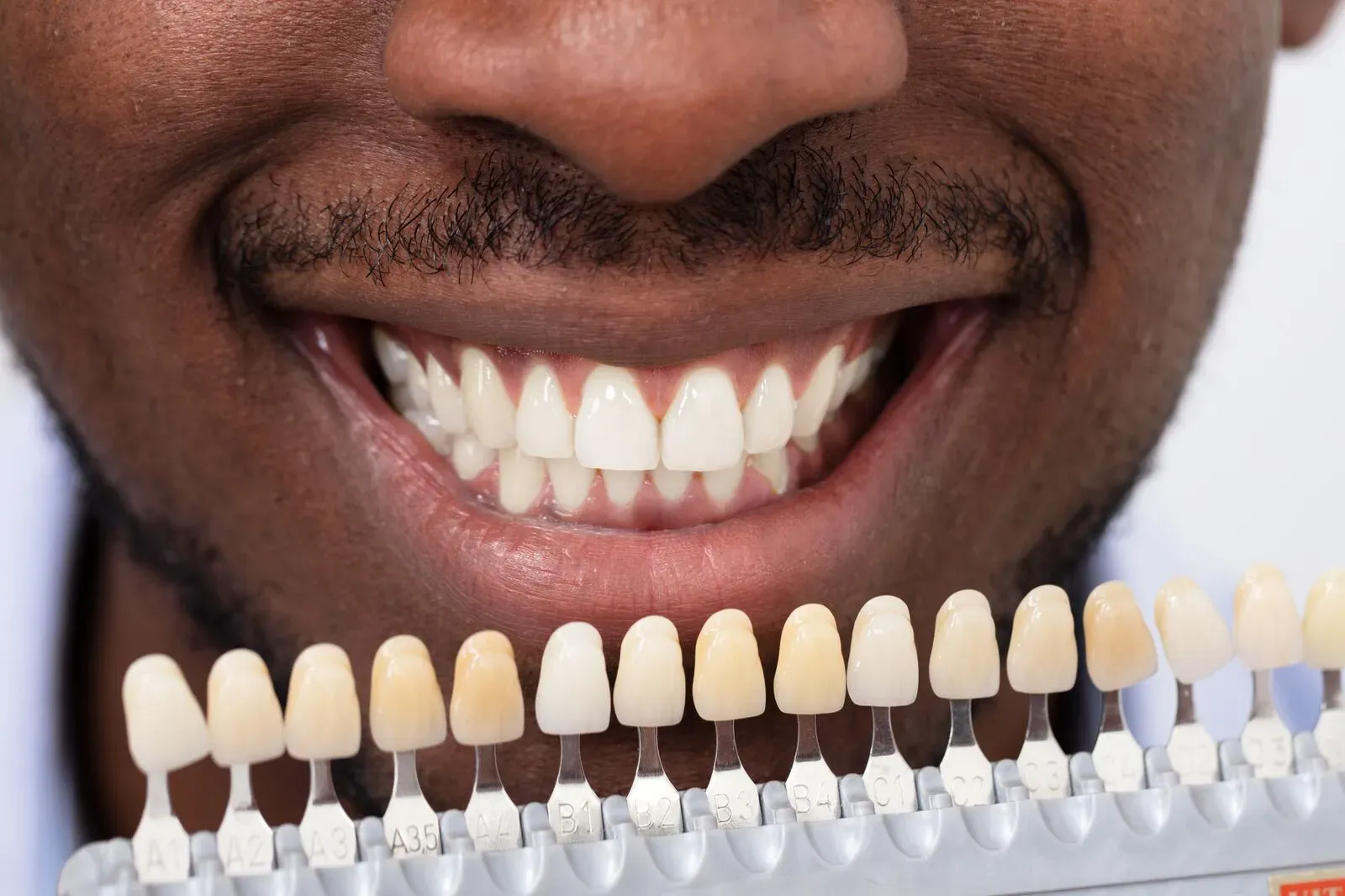 Man smiling to match color of teeth with color of new veneers