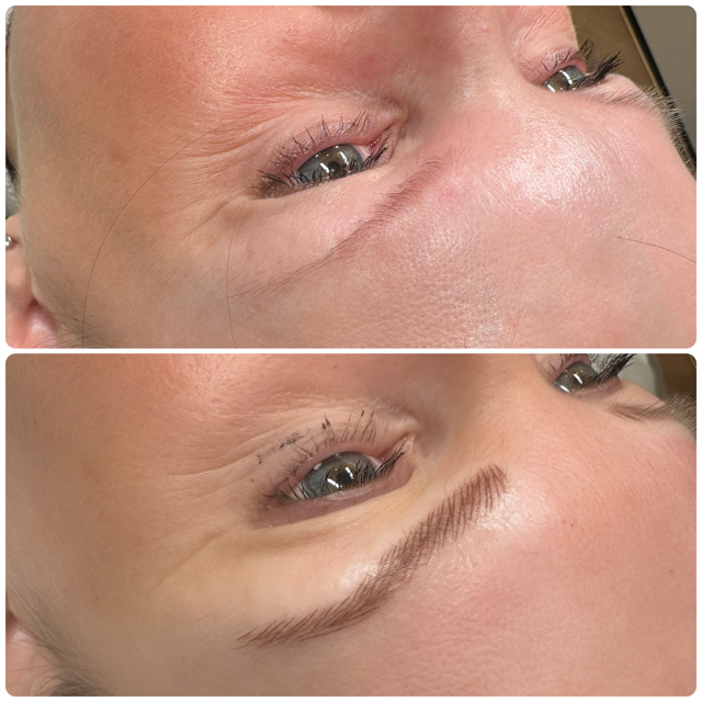 Before-and-after comparison showing the cosmetic microblading application of a new eyebrow on a person's face.