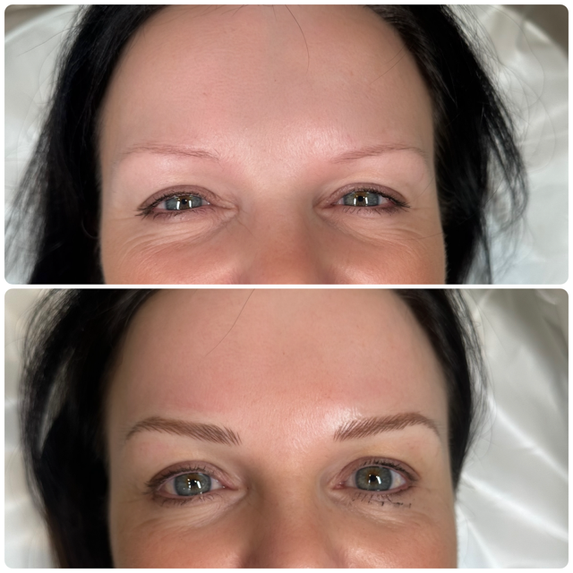 Before and after comparison of eyebrows showing the results of a cosmetic enhancement treatment.