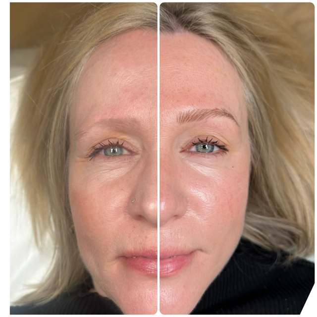 Before-and-after comparison showing a brow lamination and tint treatment on a person's eyebrow.