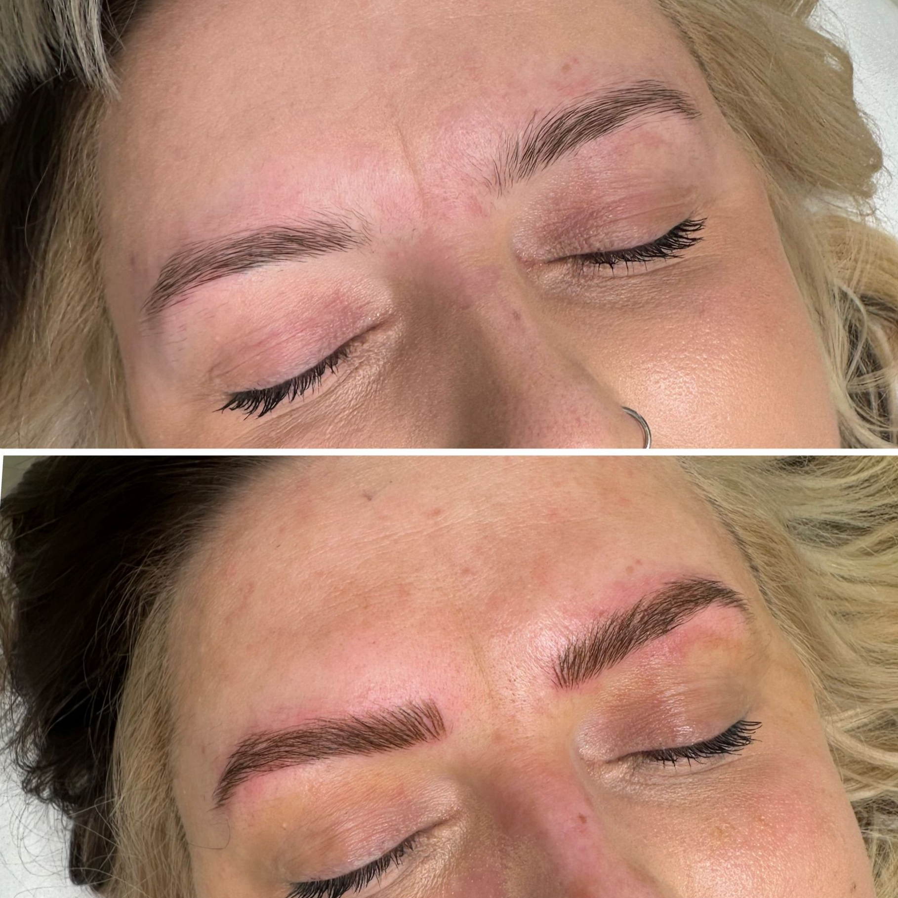 Close-up of a person with glossy, plump lips, likely after lip filler treatment; eyes closed, skin appears dewy.