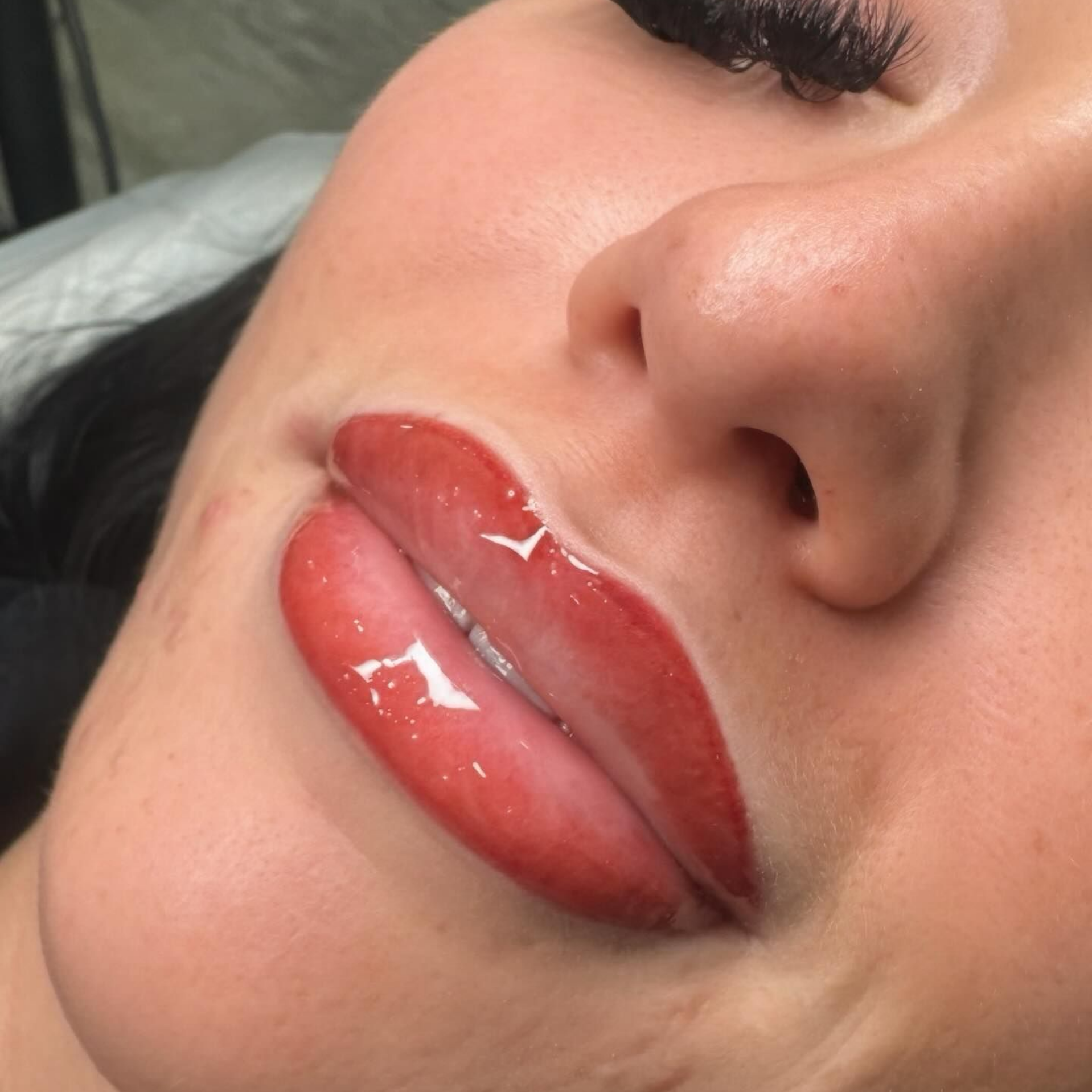 Close-up of a person with glossy, plump lips, likely after lip filler treatment; eyes closed, skin appears dewy.