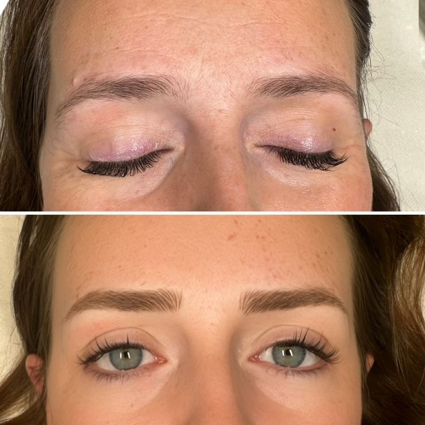 Before-and-after of a person's eyebrows. The top shows sparse brows. The bottom shows fuller, filled-in brows. Eyes open.