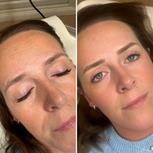 Before-and-after of a woman's eyebrows. The left shows sparse brows, the right shows fuller, tattooed brows.