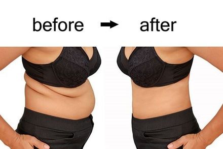 Weight Loss - Laser Spa Service in Bowie, MD