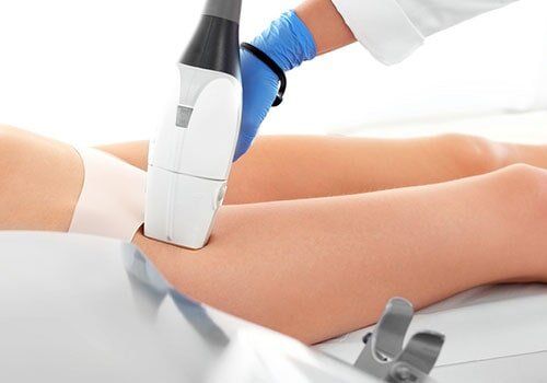 Head for laser hair removal - Laser Spa service in Bowie, MD