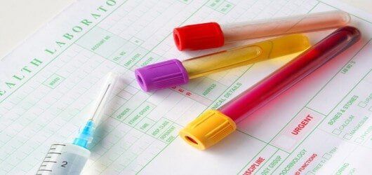 Drug test medium — workers comp in Santa Maria, CA