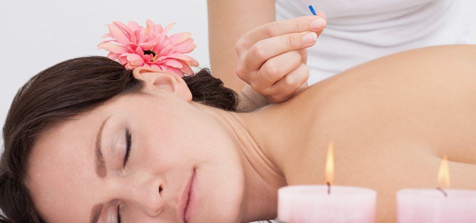 A lady having acupuncture beside two candles