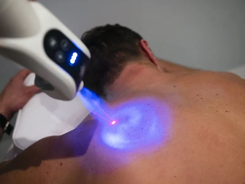 A man is getting a laser treatment on his back.