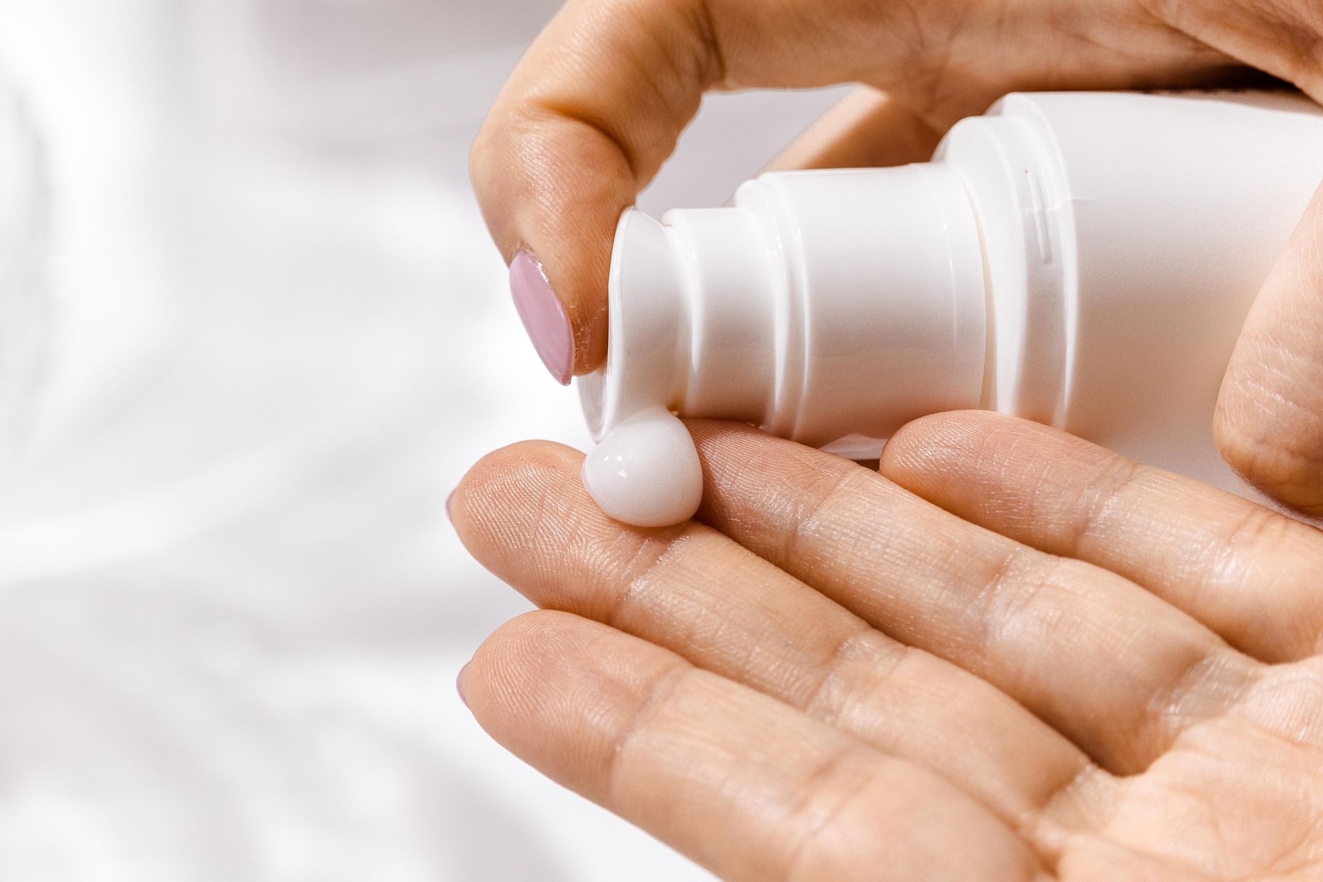 cream for eczema close up on hands