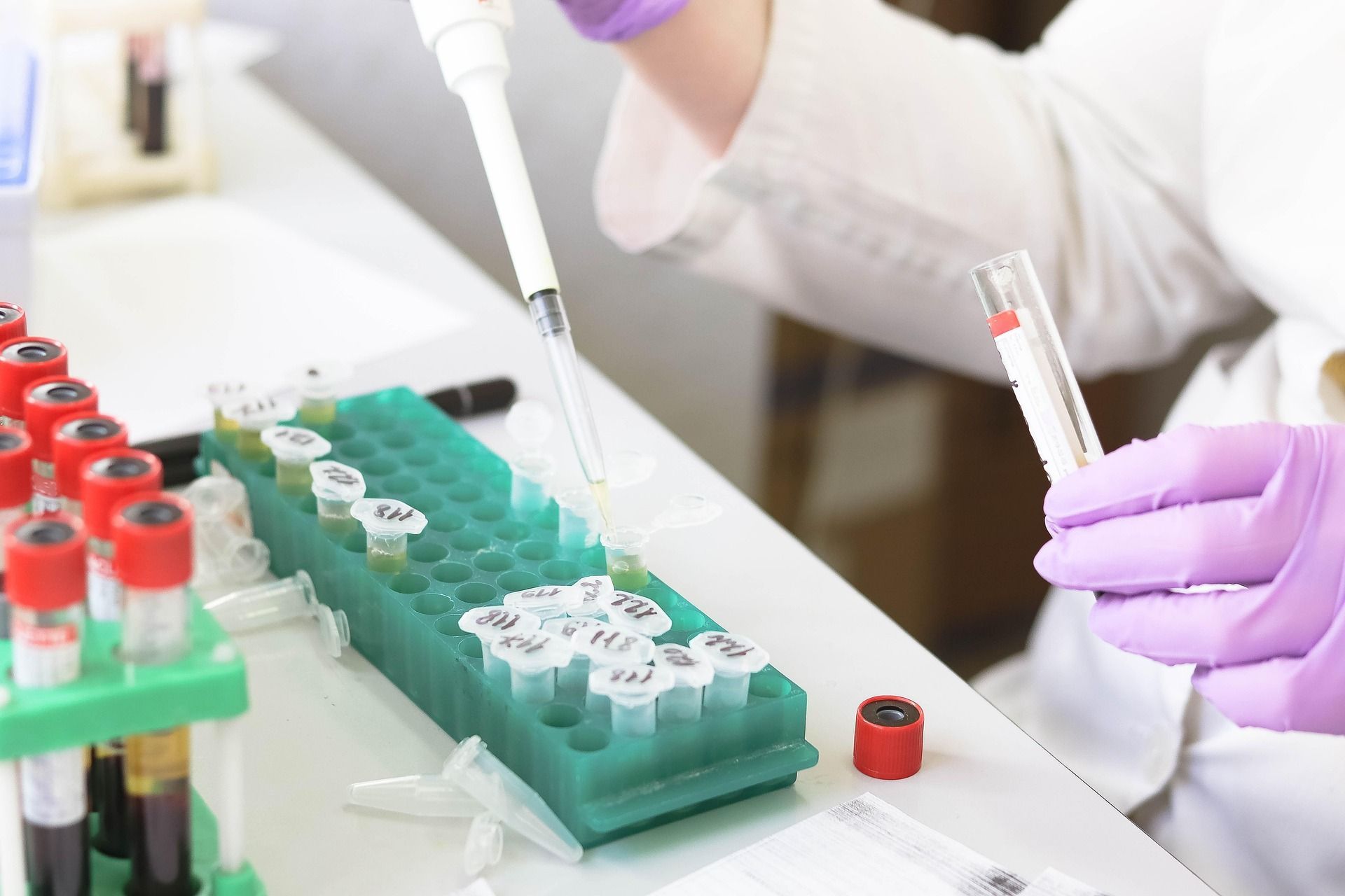 close up of laboratory test