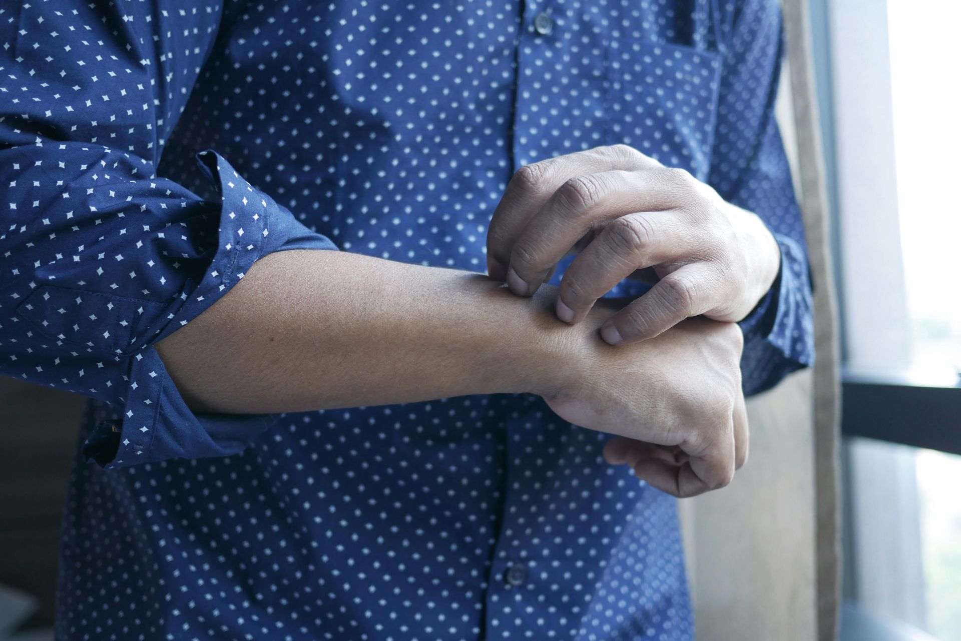 man with atopic dermatitis scratching skin on arm