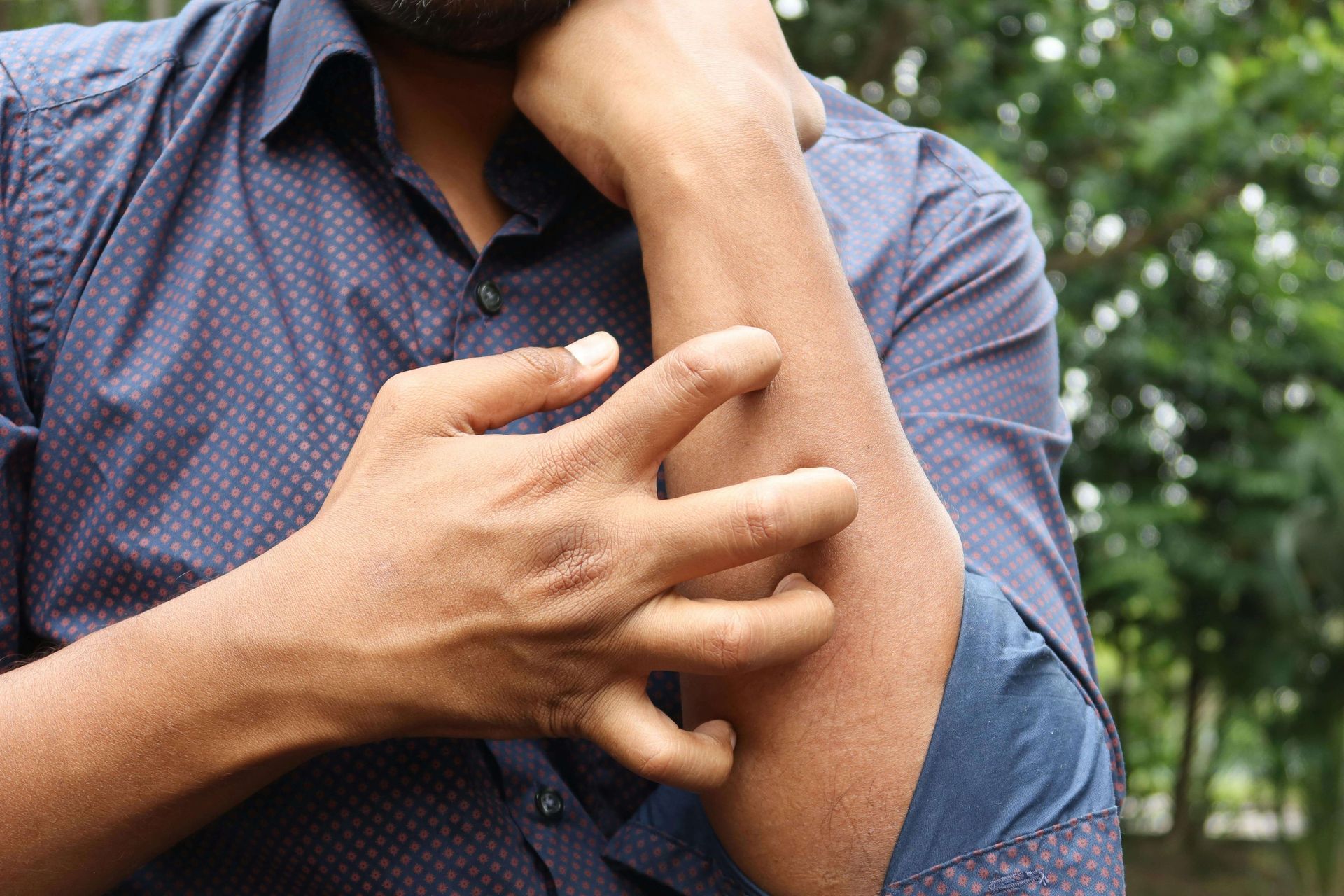 teen scratching skin on arm - drug allergy