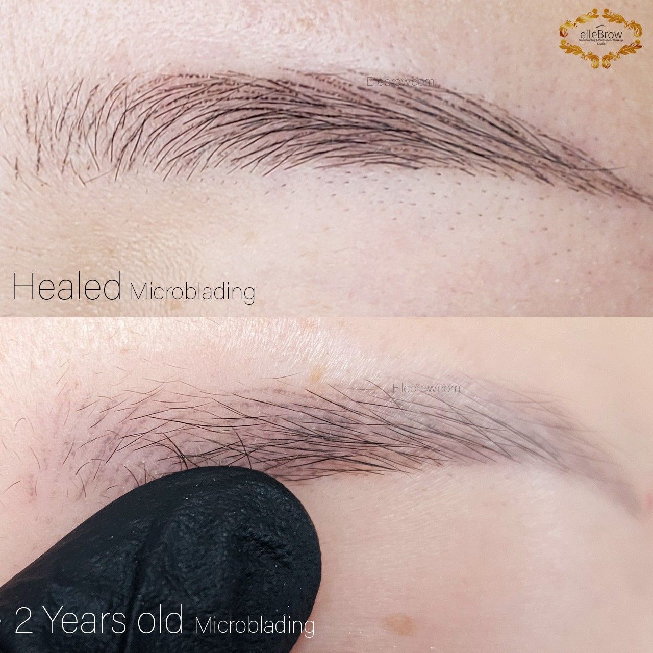 2 Year Old Quickly Faded Microblading (Atypical)