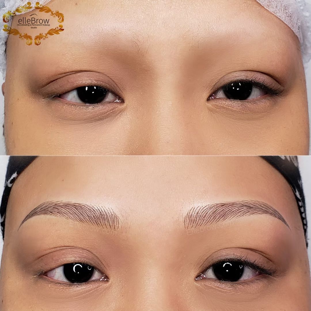 Alopecia Microblading - before and after photo