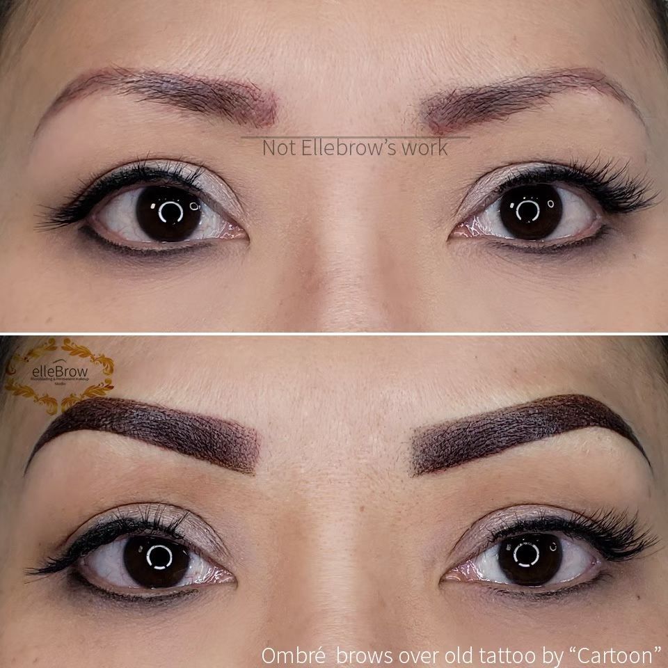 5 Year old dark and blurred microblading covered with very dark microshading 