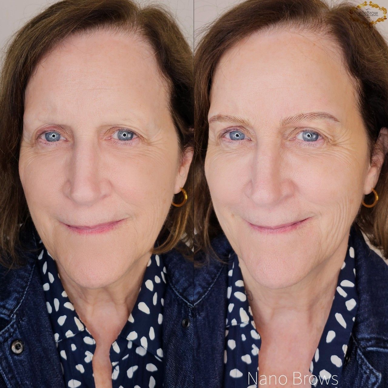 nano brows for alopecia client (full face before and after)