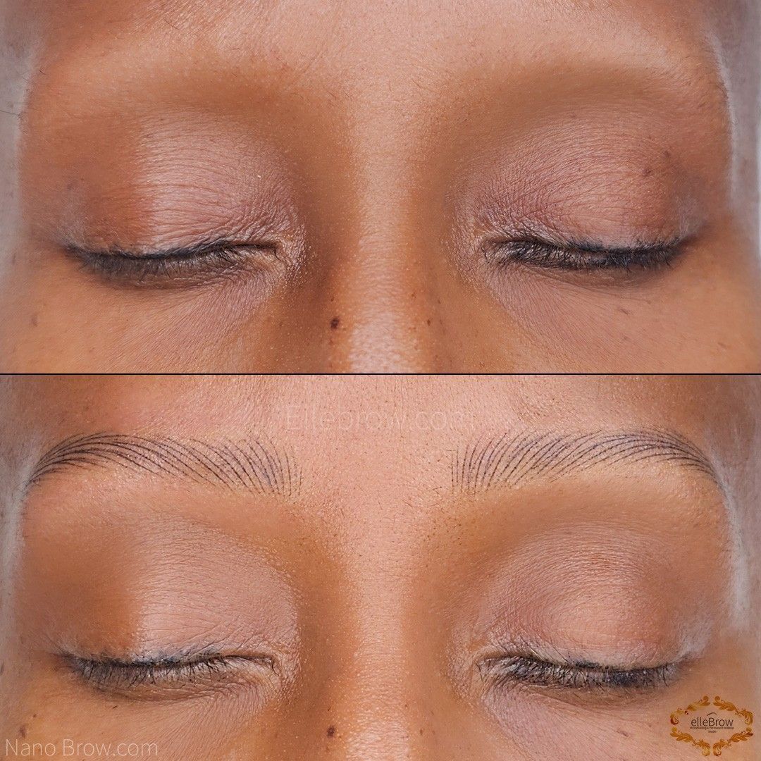 Nano Brows before and after on client with alopecia