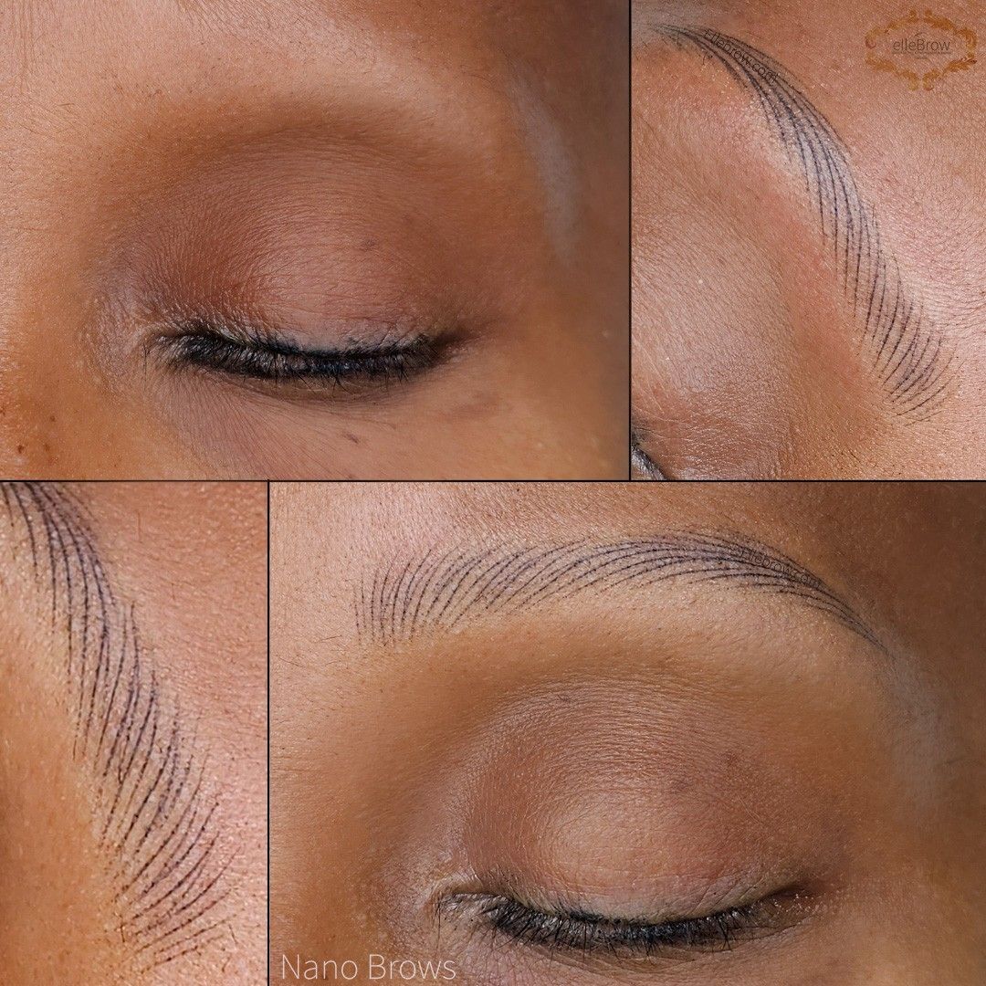 Alopecia Client after undergoing Nano Brows Treatment at Ellebrow NYC