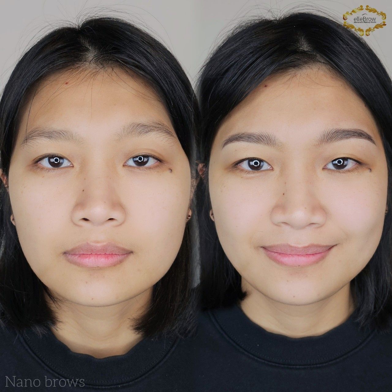 Uneven Eyebrows - Nano Brows