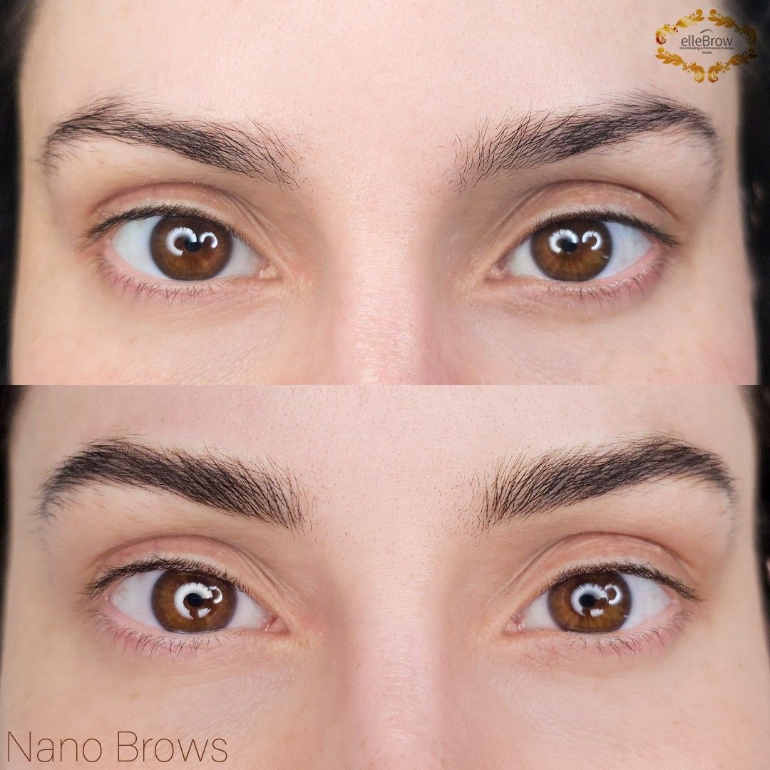 Before and After Eyebrow Enhancement (nano brows)