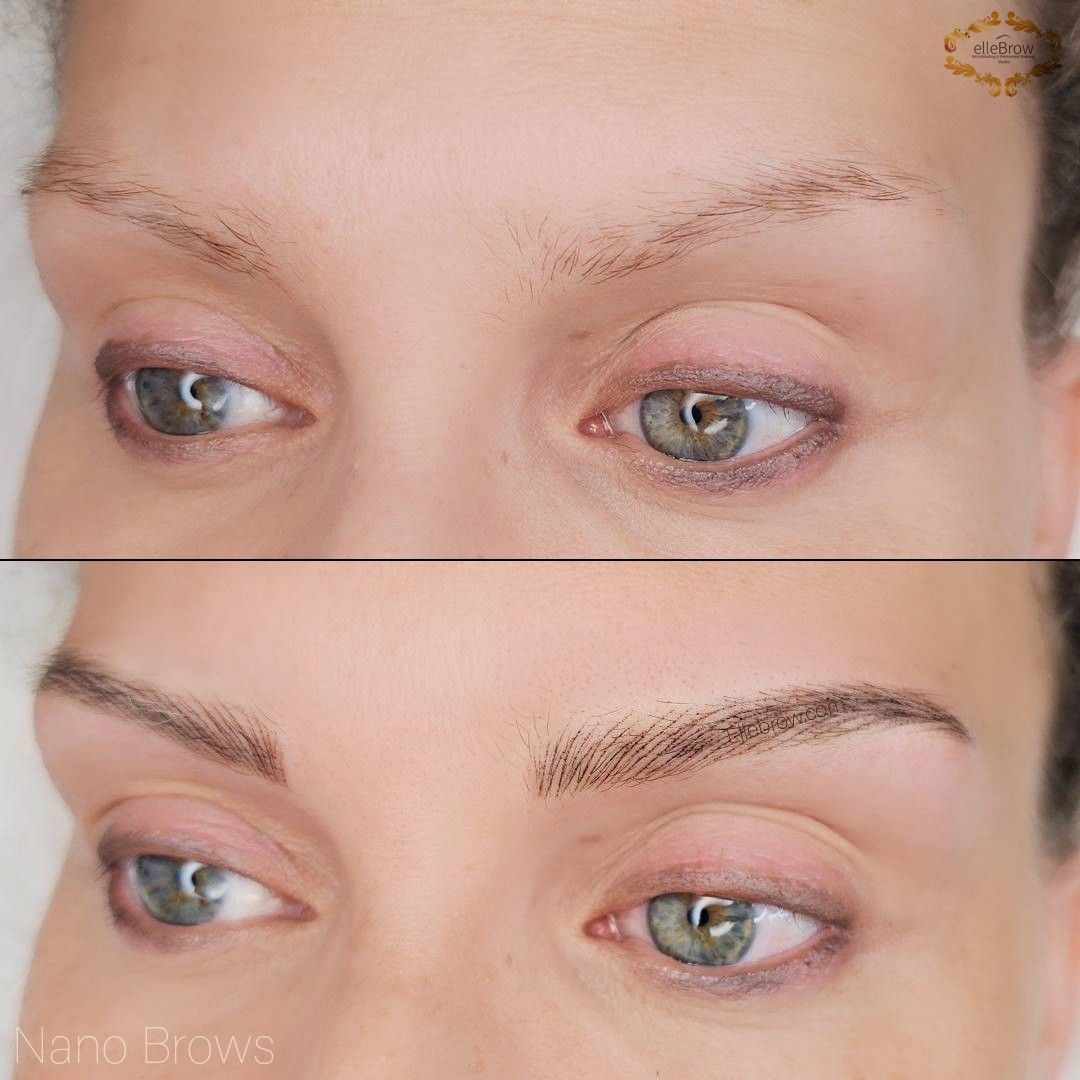 Nano Brows for Trichotillomania - before & after