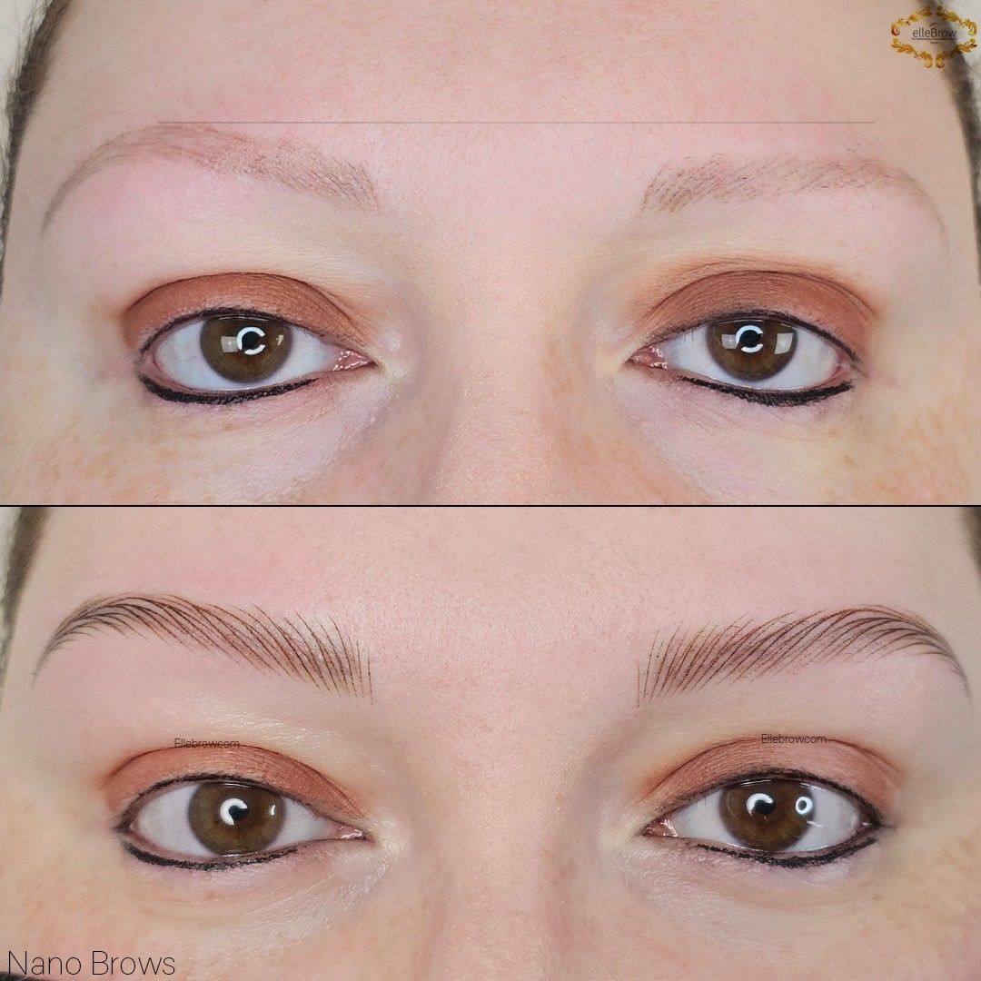 Nano Brows (microblading) on a women with Trichotillomania (before/after)